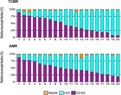 Deciphering the Complexity of the Immune Cell Landscape in Kidney Allograft Rejection